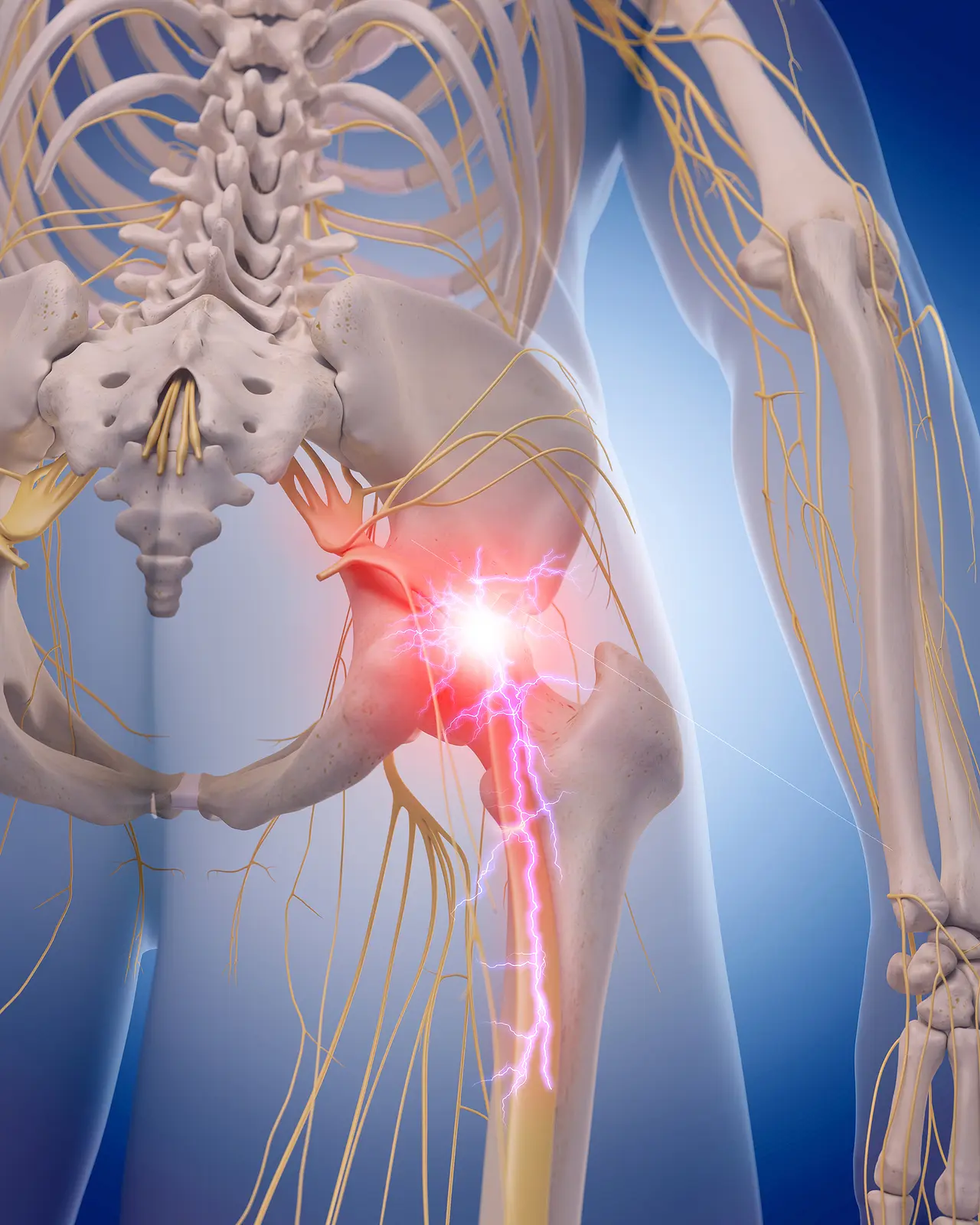 Sciatica treatment Templestowe
